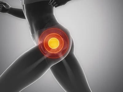 Warum Hüftschmerzen selten durch Arthrose entstehen – und was wirklich dahintersteckt