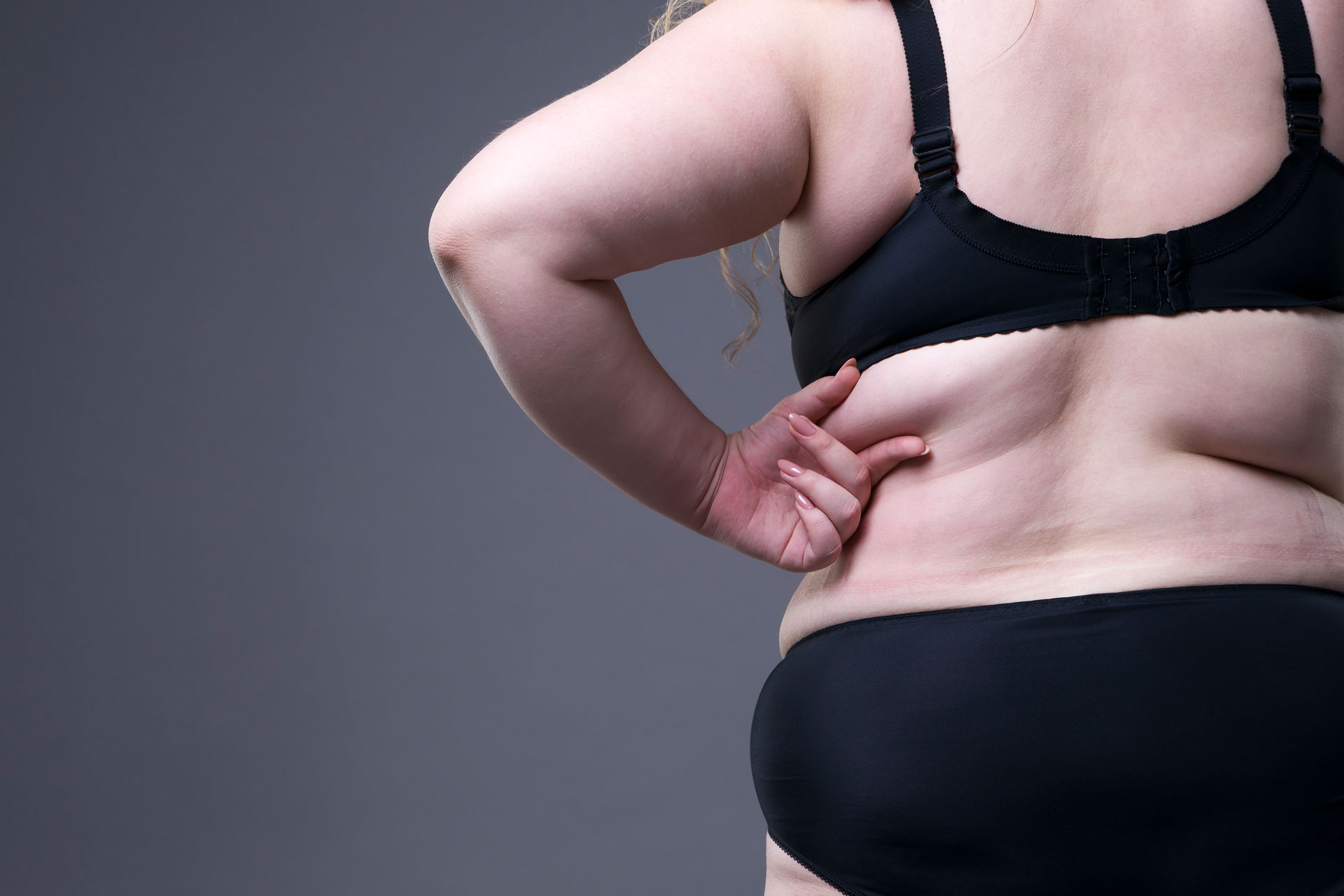 Lipödem Behandlung und psychische Gesundheit: Wie Sie sich stärken können